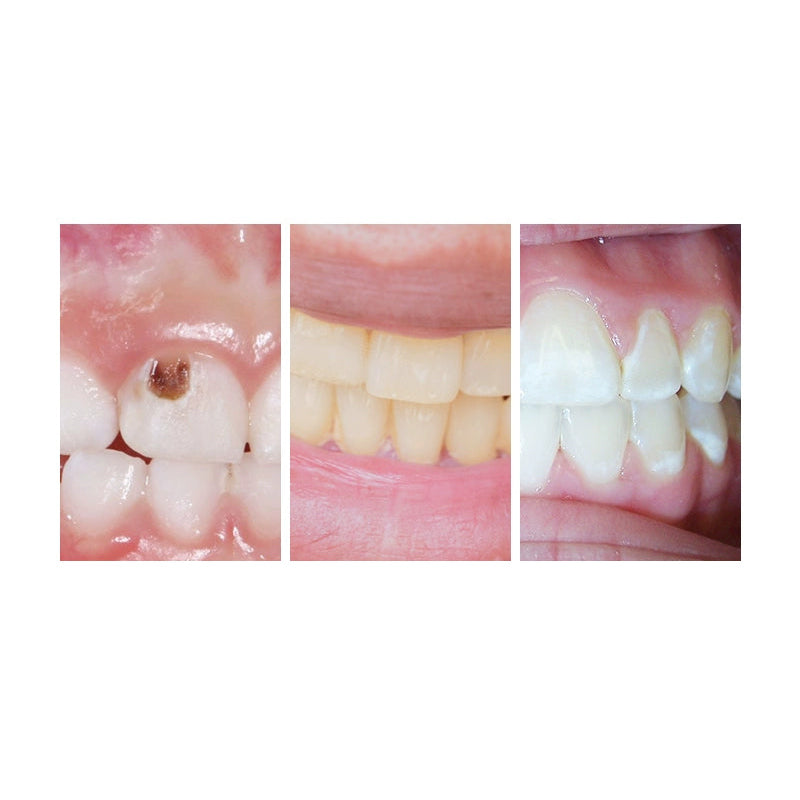 Kem đánh răng SUNSTAR Ora2 Me Stain Clear 130 g – trắng răng sạch vết ố vàng