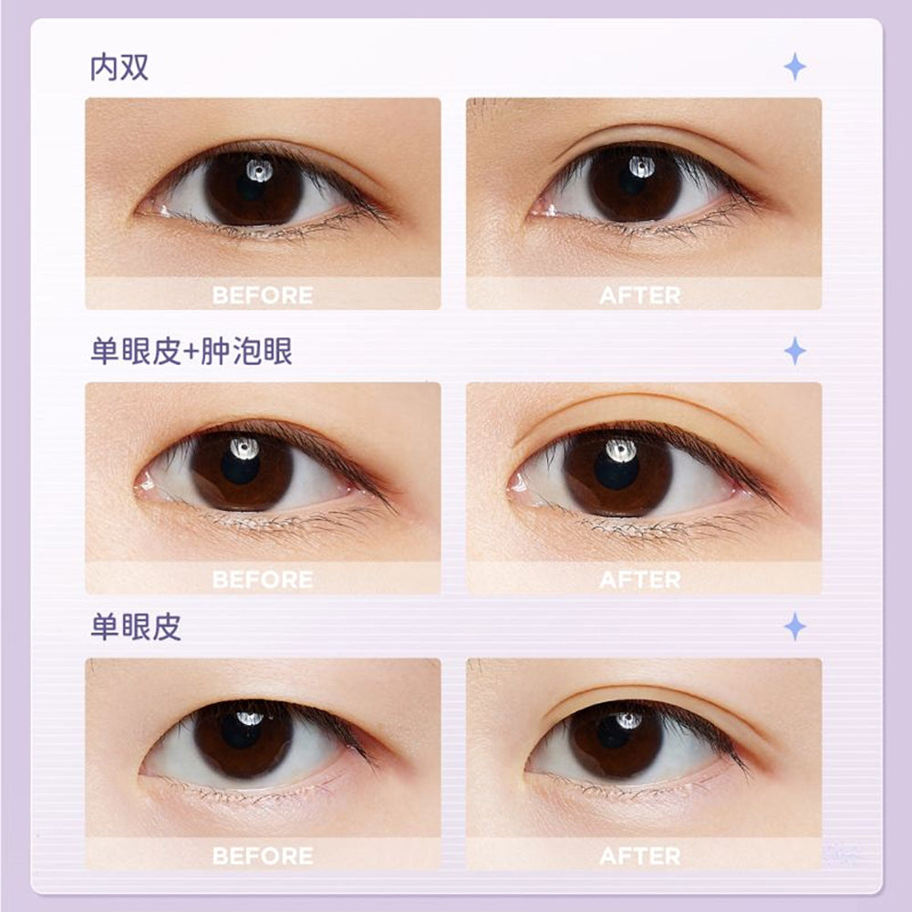 Everbab-Traceless-Eyelid-Stickers---S-Shape,-400-Pieces-1